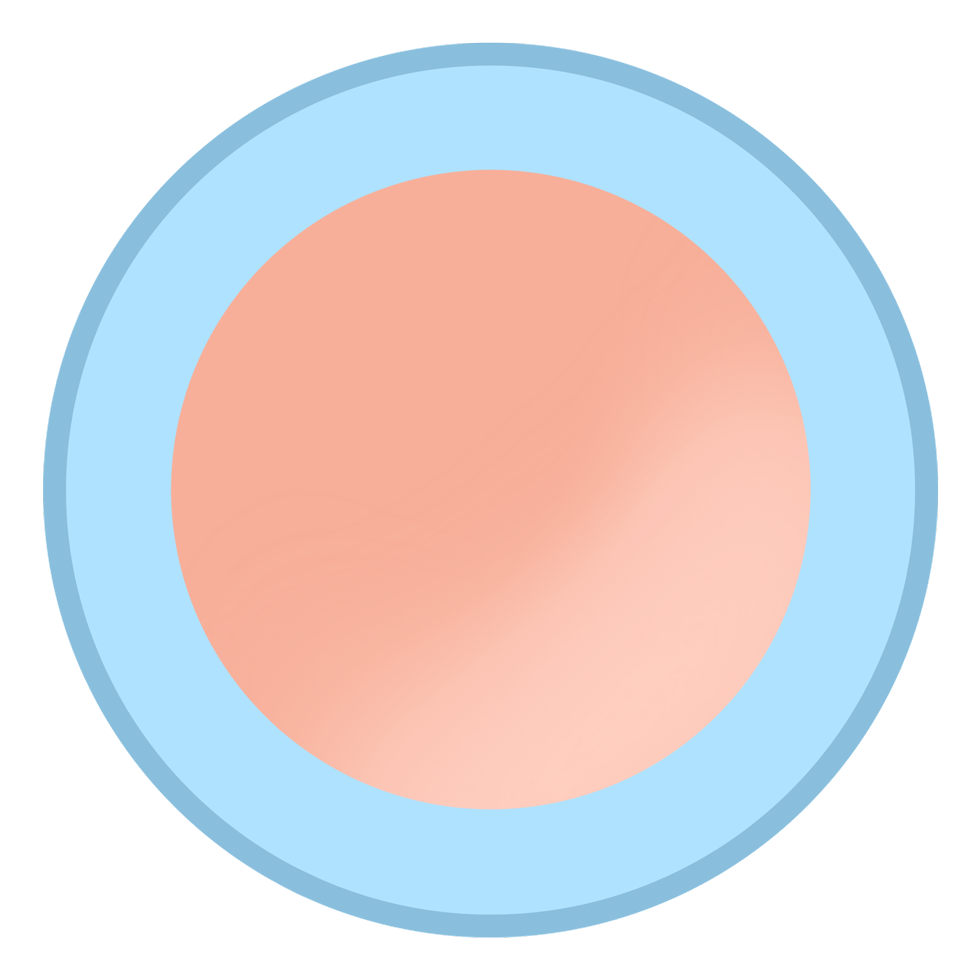 lasik_smile_compare